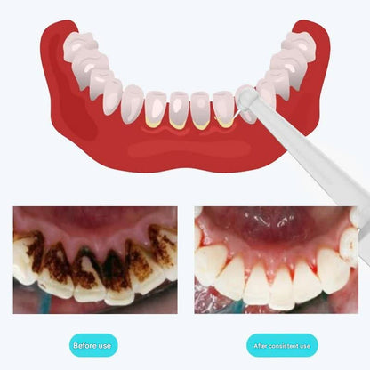 Ultrasonic Dental Scaler & Calculus Remover - 3 Modes, 2 Heads, LED Light(white)